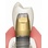 BioHorizons Tapered Internal image 69
