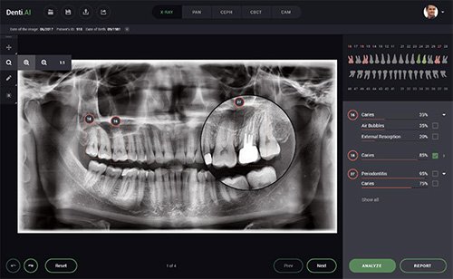 DentiAI3.jpg