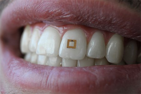 L'IOT Diet Wearable2.jpg
