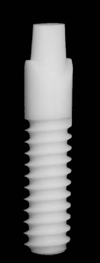 CeraRoot 12 main image